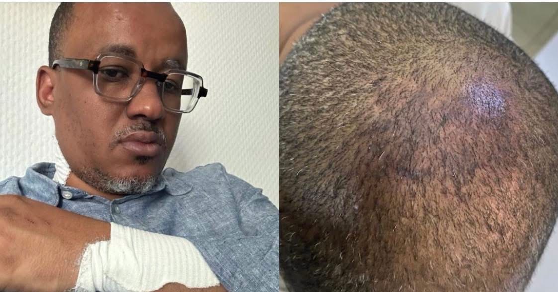 Tribunal de Pikine-Guédiawaye : l'ancien ministre-conseiller Oumar Osys Sow grièvement blessé lors d'une altercation avec un ASP